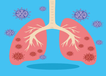 Longontsteking: oorzaken, symptomen & behandelopties