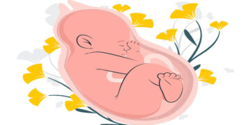 placenta-praevia - Thuispoli Placenta praevia